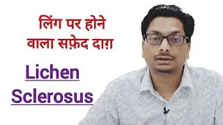 जननांग की Skin पर होने वाला सफ़ेद दाग़ Genital Lichen Sclerosus #lichensclerosus #safeddaag #vitiligo