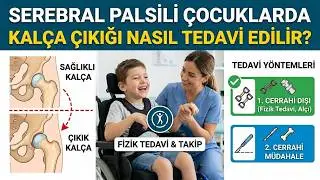 Serebral palsili çocuklarda kalça çıkığı nasıl tedavi edilir? | Prof. Dr. Yakup YILDIRIM