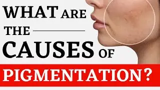 What is Pigmentation and how can you treat it? Bharat Homeopathy