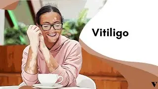 Quais os Tipos de Vitiligo? Veja as Causas e Riscos