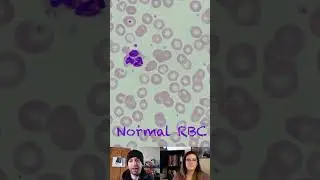 Normal RBC Morphology Characteristics
