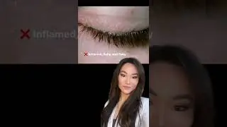Try This Instead Of That For Dry Eyes: Cequa