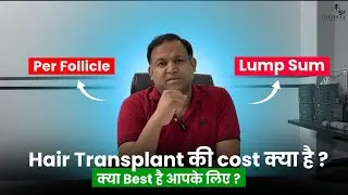 Hair Transplant Cost in India Revealed!