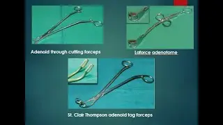 Adenoid through cutting forceps | Laforce adenotome | St. Clair Thompson adenoid tag forceps