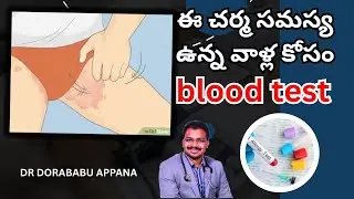 What test should be done for this skin problem |blood tests for allergy | skin allergy | skin inf...