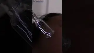 The first Fusion cold plasma fusion device for skin rejuvenation!#skincare