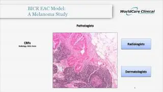 Subjective endpoints in clinical trials - Video abstract 50283