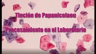 Tinción de Papanicolaou: Procedimiento en el Laboratorio🔬🔬. No se olviden de suscribirse 👍👍🤝🤝‼️‼️