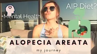 My Alopecia Areata Journey | AIP Diet | HAIR REGROWTH!
