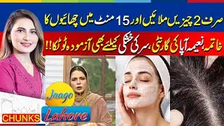 Mix 2 ingredients to remove dandruff in 15 minutes – Naeema Apa’s trusted tip for dry scalp.