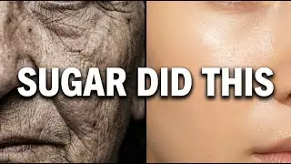 The Hidden Dangers of Sugar | How Sugar Ages You From the Inside Out