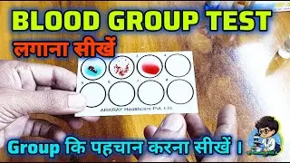 ABO ( Blood Group Test ) in hindi practical 🩸 #test #group #bloodtest #science #medicaltest #lab