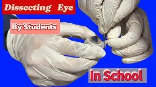 Dissection of Sheep Eye#experiment #Practical#laboratory #school #students