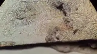 Gyrodactylus salaris (Fish Parasite)