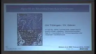 Dr. Johannes Coy - TAVARLIN - Sicherer Bluttest zum fr&uuml;hzeitigen Nachweis von Krebserkrankungen