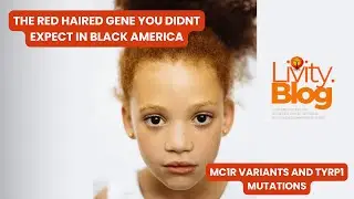 The Red Hair Gene You Didn't Expect in Black America