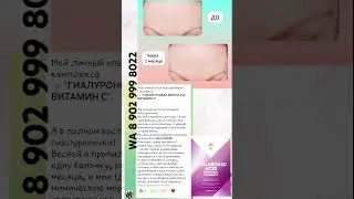 Переходи по ссылке в шапке профиля и я расскажу как приобрести 👌🏻
