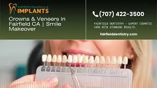 Dental Crowns & Veneers in Fairfield, CA | Cosmetic Smile Makeovers