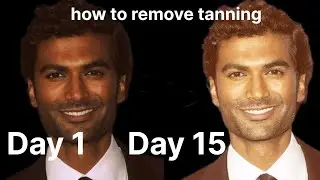 How to remove Tanning (No Clickbait)