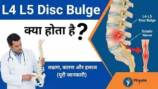 L4-L5 Disc Bulge क्या होता है? | Symptoms, Causes & Treatment in Hindi | Sciatica Relief