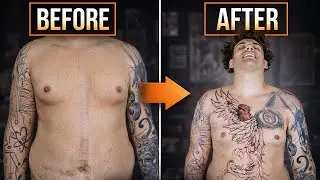 Turning a Surgery Scar into Art | Full Stomach Tattoo Session