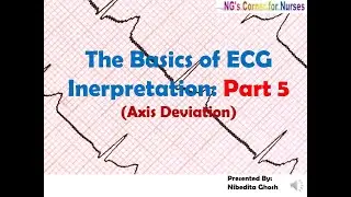 The Basics of ECG Interpretation: Part-5: Axis Deviation