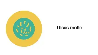 Ulcus molle (Weicher Schanker) - Infektionskrankheiten