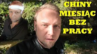 Przeszczep Włosów w Turcji JAK BYŁO