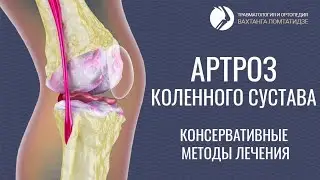 Лечение коленного сустава с помощью электрофореза 