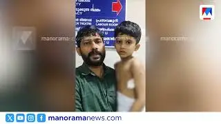 മുറ്റത്ത് കളിക്കുമ്പോൾ തെരുവുനായ 6 വയസ്സുകാരനെ കടിച്ചു | Stray dog attack Palakkad