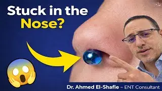 ⭐Foreign Object in a Child&rsquo;s Nose: Warning Signs Parents Should Never Ignore