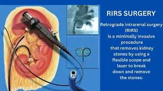 Urology Solutions for Advanced Laparoscopic Treatments #kidneydoctor #doctor #doctorslifestyle