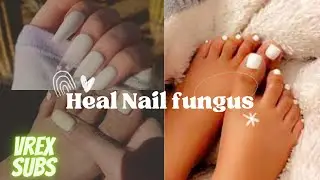 NAIL FUNGUS HEAL+ PREVENT ✨