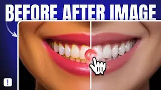 Add Before and After Image Slider That Shows Real Transformations!