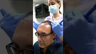 Transforming lives through the art of hair restoration 👌🏻