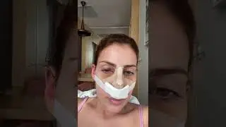 Getting a nose job in Turkey! 🇹🇷 #vlog #nosejobinturkey #rhinoplasty
