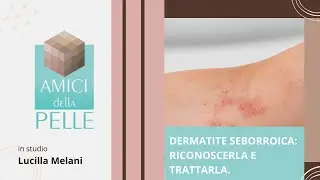 Dermatite seborroica: riconoscerla e trattarla.