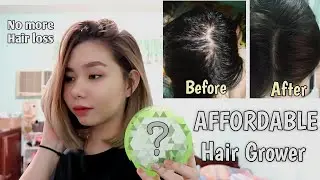 Effective HAIR GROWER for Hair Loss + Hair Fall | Paano humaba ng mabilis ang buhok?