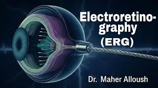 تخطيط الشبكية الكهربائي ERG - د.ماهر علوش