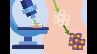 Brillouin Microscopy: The Future of Non-Invasive Tissue Analysis and Diagnostics