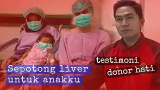 Testimoni donor hati / transplantasi hati / cangkok hati / alagile syndrome