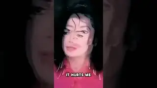 It was all Vitiligo. Michael never bleached his skin. #michaeljackson