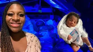 BABY’S 👶🏾 1st BATH 🛁 IN THE NICU AGENESIS OF THE CORPUS CALLOSUM (MISSING BRAIN) 🧠 + JAUNDICE