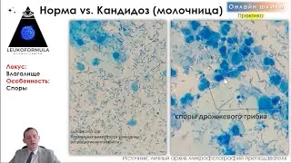 Микроскопическое исследование отделяемого влагалища, уретры, цервикального канала на флору. Трейлер.