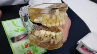 اهمية المتابعة  الدوريةلنمو الاسنان وصحتها .  Follw up of Dental Development & Health