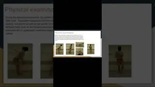 LBP in overhead sports