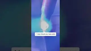 Teknik welding tig stainless steel hollow #welding #steel #easy #welder