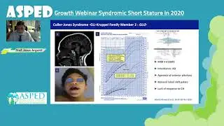 ASPED Growth Webinar: Syndromic Short Stature