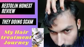 Restolin Review | My Honest Opinion About Restolin Hair Supplement| My Results After Use | #restolin