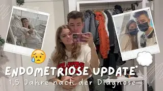 ENDOMETRIOSE Update: 1,5 Jahre nach der OP! 🩺💭| Hans&Wika